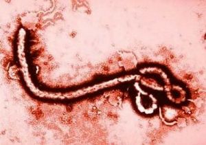 virus-do-ebola-contagio-se-da-pelo-contato_1